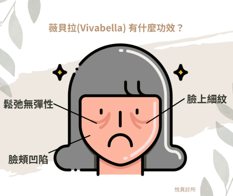 【2024熟女救星】Vivabella 薇貝拉通過認證來臺灣！人稱「魔法針」有效解決凹陷皺紋臉！