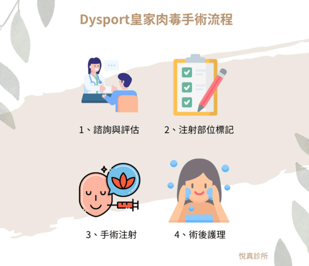 Dysport皇家肉毒手術流程